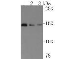 TSC1 Antibody in Western Blot (WB)