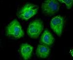 CD146 Antibody in Immunocytochemistry (ICC/IF)