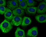 Vinculin Antibody in Immunocytochemistry (ICC/IF)