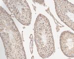 Vinculin Antibody in Immunohistochemistry (Paraffin) (IHC (P))