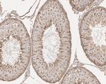 Vinculin Antibody in Immunohistochemistry (Paraffin) (IHC (P))