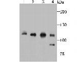 Vinculin Antibody in Western Blot (WB)