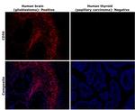 CD56 (NCAM) Antibody in Immunohistochemistry (Paraffin) (IHC (P))