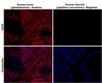 CD56 (NCAM) Antibody