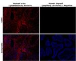 CD56 (NCAM) Antibody