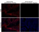 CD56 (NCAM) Antibody