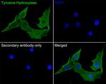 Tyrosine Hydroxylase Antibody in Immunocytochemistry (ICC/IF)