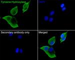 Tyrosine Hydroxylase Antibody in Immunocytochemistry (ICC/IF)