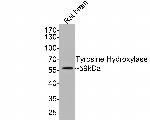 Tyrosine Hydroxylase Antibody in Western Blot (WB)