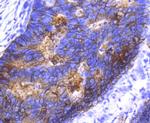 EpCAM Antibody in Immunohistochemistry (Paraffin) (IHC (P))