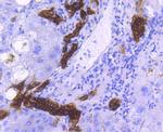 EpCAM Antibody in Immunohistochemistry (Paraffin) (IHC (P))