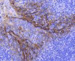 EpCAM Antibody in Immunohistochemistry (Paraffin) (IHC (P))