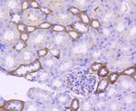 EpCAM Antibody in Immunohistochemistry (Paraffin) (IHC (P))