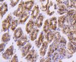 EpCAM Antibody in Immunohistochemistry (Paraffin) (IHC (P))