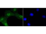 Phospho-AKT1 (Ser473) Antibody in Immunocytochemistry (ICC/IF)