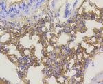 Phospho-AKT1 (Ser473) Antibody in Immunohistochemistry (Paraffin) (IHC (P))