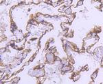 Alpha-Smooth Muscle Actin Antibody in Immunohistochemistry (Paraffin) (IHC (P))