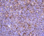 Alpha-Smooth Muscle Actin Antibody in Immunohistochemistry (Paraffin) (IHC (P))