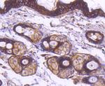 Alpha-Smooth Muscle Actin Antibody in Immunohistochemistry (Paraffin) (IHC (P))