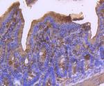 Alpha-Smooth Muscle Actin Antibody in Immunohistochemistry (Paraffin) (IHC (P))