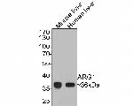 Arginase 1 Antibody in Western Blot (WB)