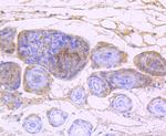 EGFR Antibody in Immunohistochemistry (Paraffin) (IHC (P))