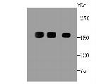 EGFR Antibody in Western Blot (WB)