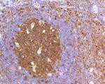 Caspase 3 Antibody in Immunohistochemistry (Paraffin) (IHC (P))