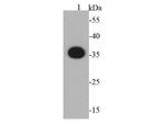 S tag Antibody in Western Blot (WB)