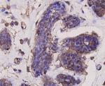 AKT1 Antibody in Immunohistochemistry (Paraffin) (IHC (P))