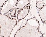 PAX8 Antibody in Immunohistochemistry (Paraffin) (IHC (P))