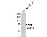 COX2 Antibody in Immunohistochemistry (Paraffin) (IHC (P))