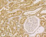 APE1 Antibody in Immunohistochemistry (Paraffin) (IHC (P))