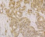 APE1 Antibody in Immunohistochemistry (Paraffin) (IHC (P))