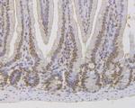 MSH2 Antibody in Immunohistochemistry (Paraffin) (IHC (P))