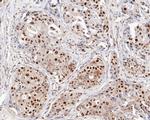 MSH2 Antibody in Immunohistochemistry (Paraffin) (IHC (P))