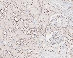 MSH2 Antibody in Immunohistochemistry (Paraffin) (IHC (P))