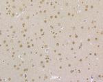 MSH2 Antibody in Immunohistochemistry (Paraffin) (IHC (P))