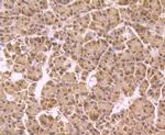 NFIB Antibody in Immunohistochemistry (Paraffin) (IHC (P))