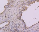 NFIB Antibody in Immunohistochemistry (Paraffin) (IHC (P))