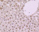 NFIB Antibody in Immunohistochemistry (Paraffin) (IHC (P))