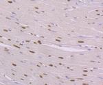 NFIB Antibody in Immunohistochemistry (Paraffin) (IHC (P))