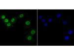 PTBP1 Antibody in Immunocytochemistry (ICC/IF)