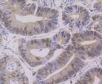 PTBP1 Antibody in Immunohistochemistry (Paraffin) (IHC (P))