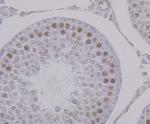 PTBP1 Antibody in Immunohistochemistry (Paraffin) (IHC (P))