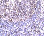 IL-6 Antibody in Immunohistochemistry (Paraffin) (IHC (P))