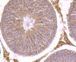 SMAD2 Antibody in Immunocytochemistry (ICC/IF)