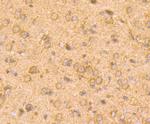 SMAD2 Antibody in Immunohistochemistry (Paraffin) (IHC (P))