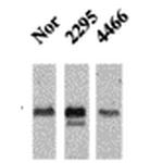 CaMKII alpha/beta Antibody in Western Blot (WB)