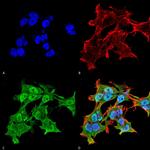 Alpha A Crystallin Antibody in Immunocytochemistry (ICC/IF)